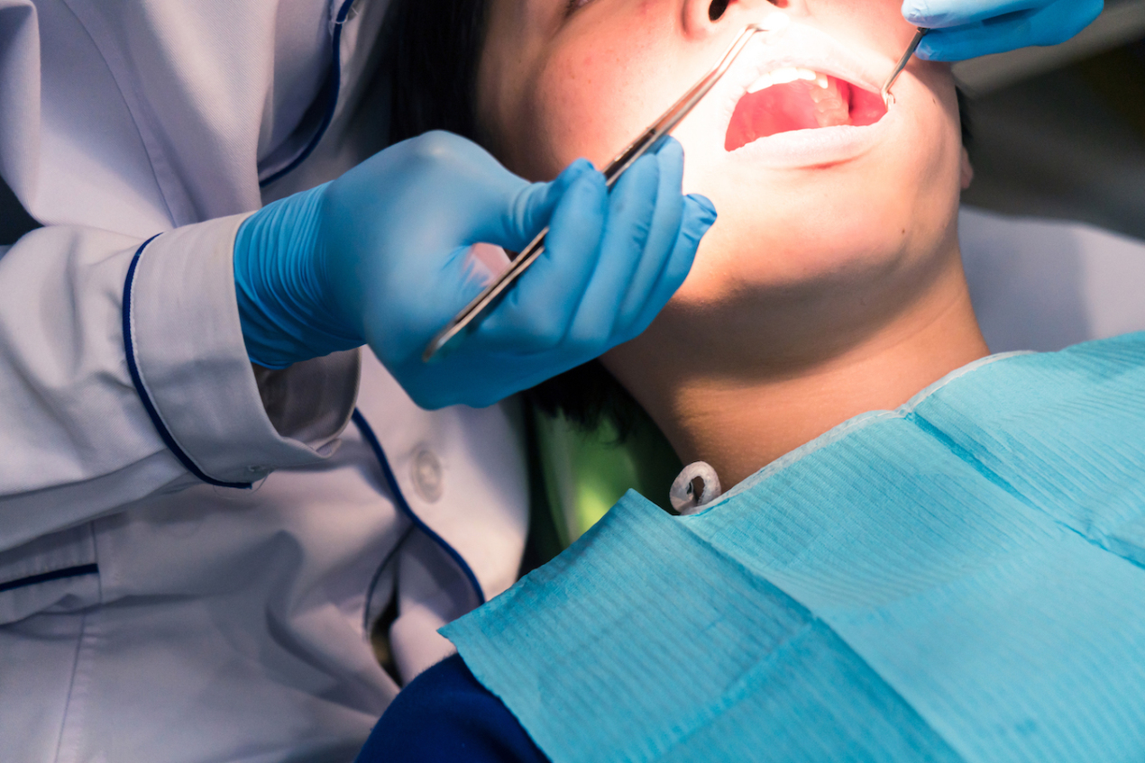 Benefits of Hiring a Professional Dentist Dental - Dentist